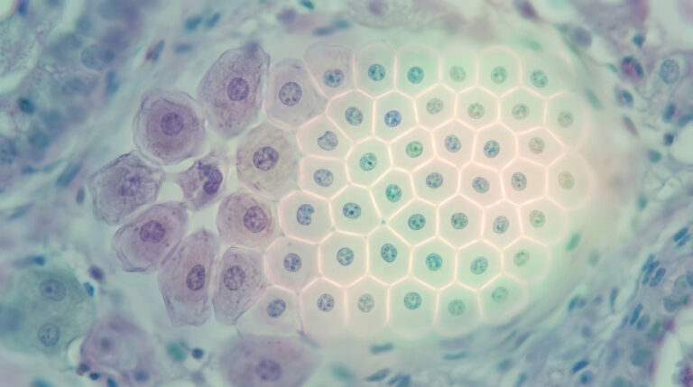 Microscopic image showing human epithelial cells transitioning from irregular purple (dysplastic) to glowing, uniform blue-green (healthy).